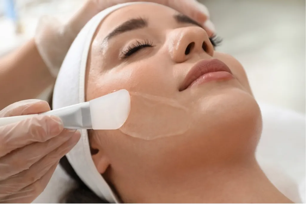 Chemical Peel